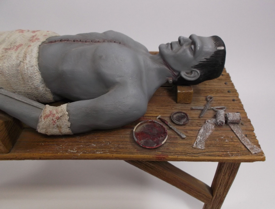 The Operation 1/6 Scale Resin Model Kit - Click Image to Close